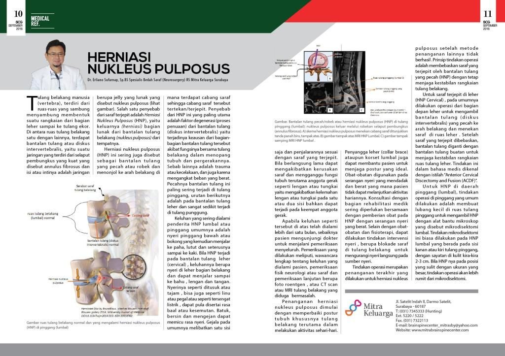 HNP (Herniasi Nukleus Pulposus)