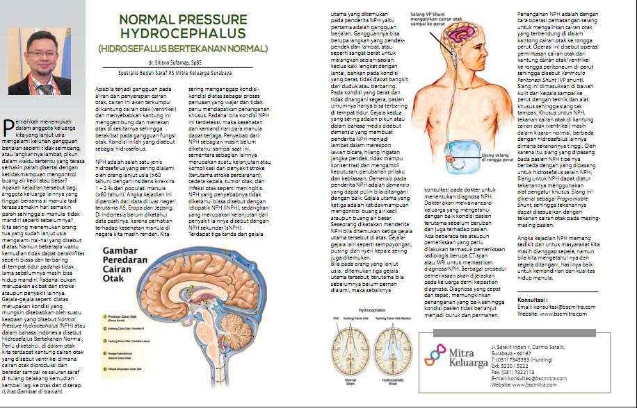 Apakah Normal Pressure Hydrocephalus (NPH)?