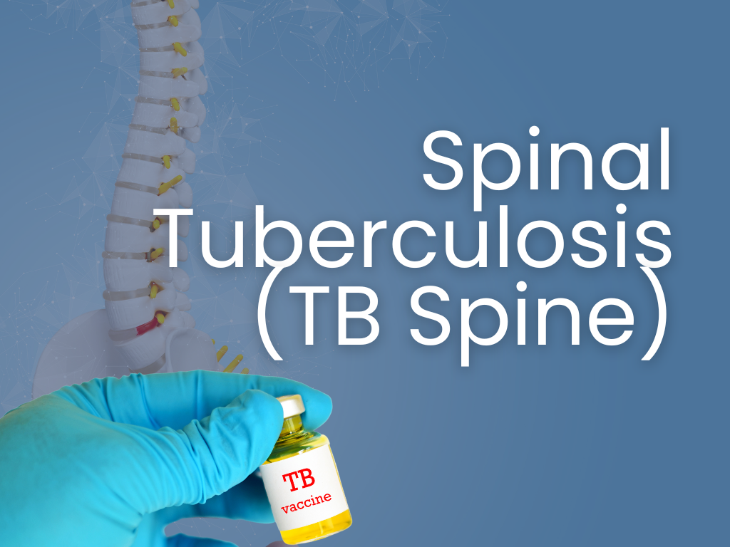 Spinal Tuberculosis (TB Spine)