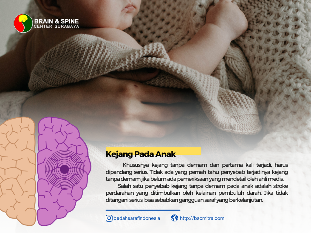 Kejang tanpa demam pada anak