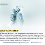 facet block injection adalah