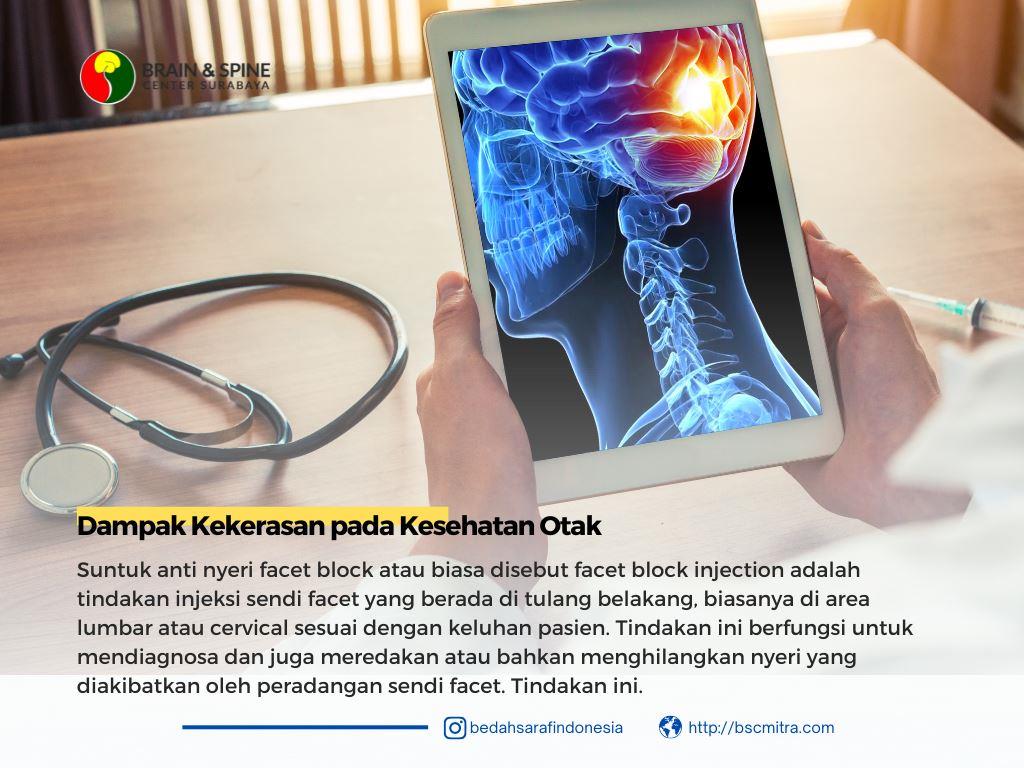 Dampak Kekerasan pada Kesehatan Otak: Apa yang Harus Anda Ketahui