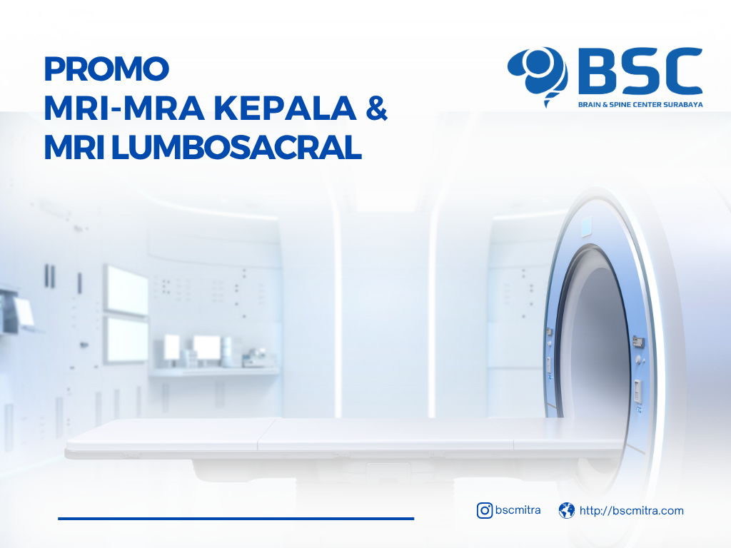 MRI Kepala: Deteksi Dini Masalah Otak yang Tak Boleh Diabaikan