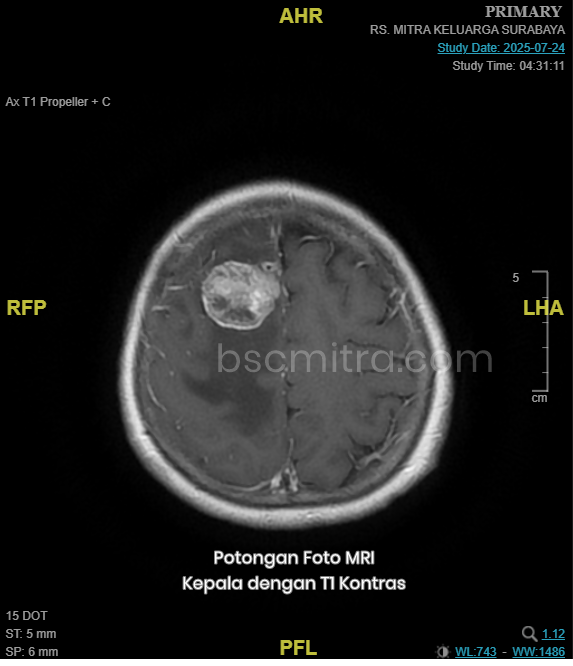MRI Kontras dan Non-Kontras: Memahami Perbedaannya untuk Diagnosis yang Lebih Akurat