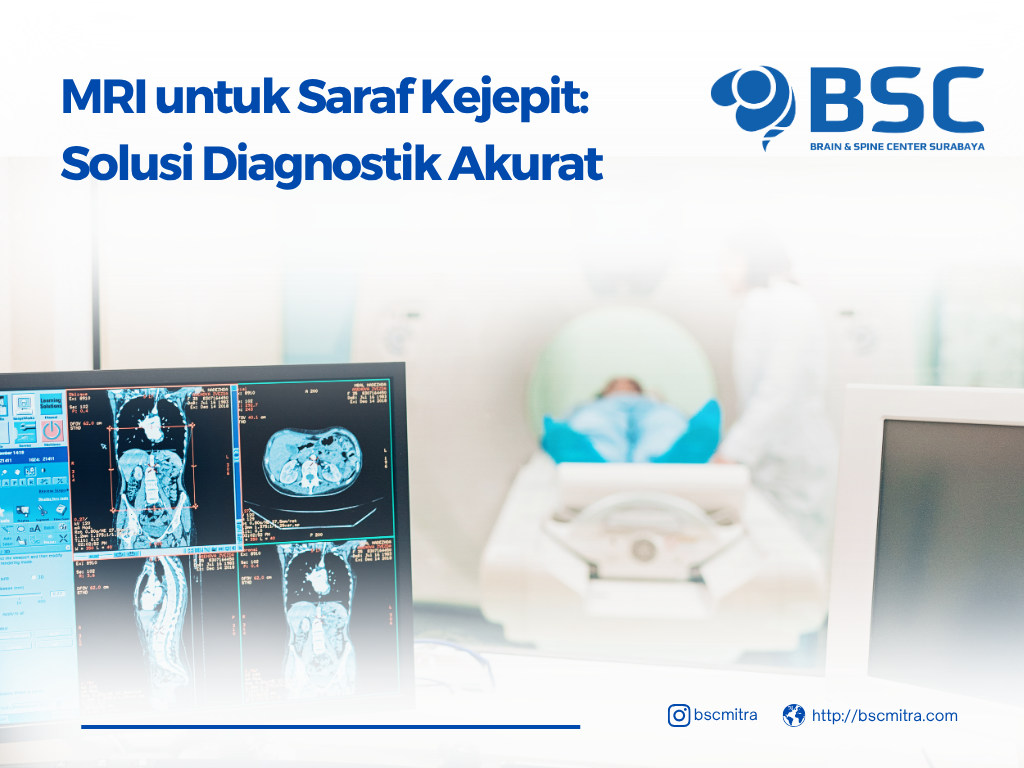 MRI untuk Saraf Kejepit: Solusi Diagnostik Akurat