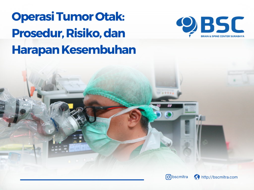 Operasi Tumor Otak: Prosedur, Risiko, dan Harapan Kesembuhan