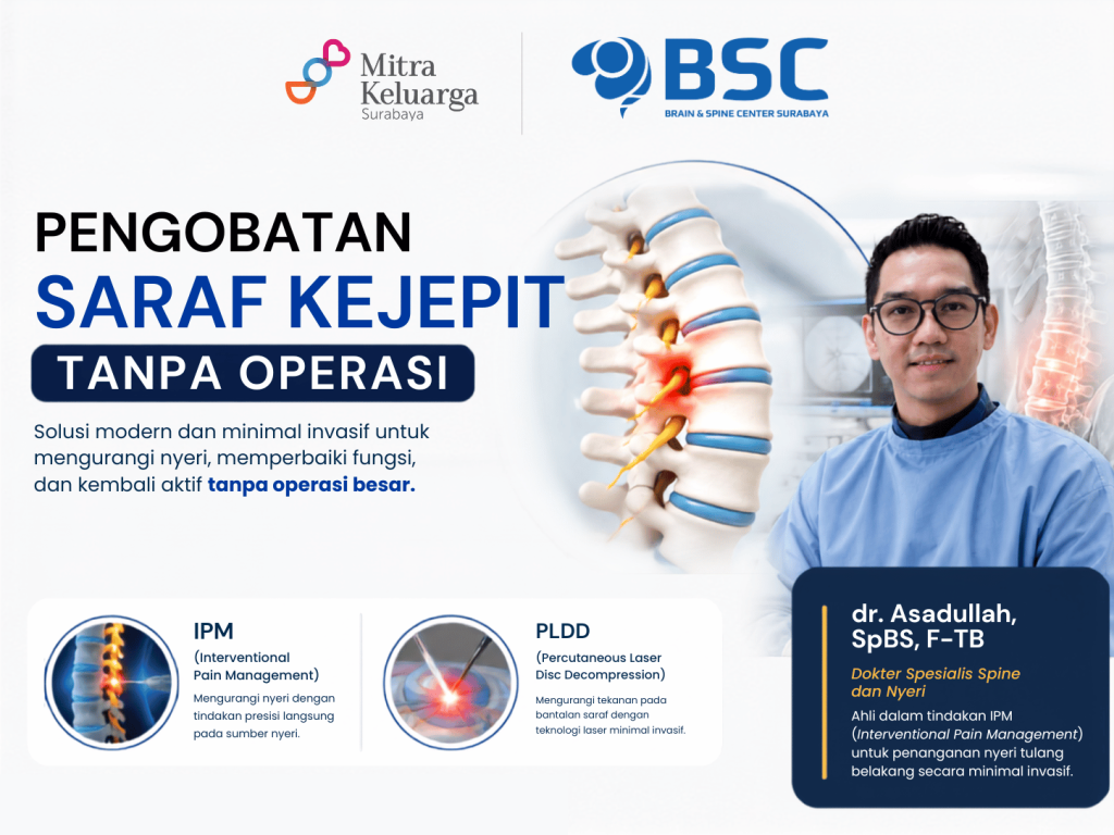 Pengobatan Saraf Kejepit Tanpa Operasi