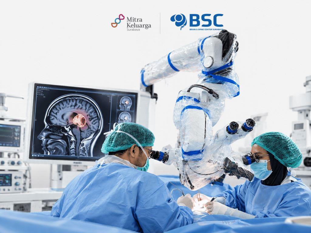 Operasi Tumor Otak: Teknologi Mikroskop Bedah dan Presisi